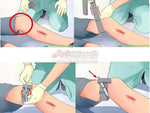 [IdiotTailor] CAT Combat Application Tourniquet[Nylon][BLK]